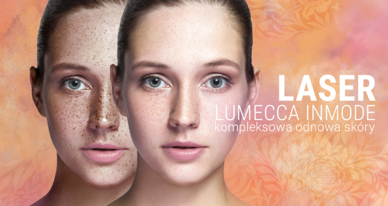 Laser LUMECCA InMode – usuwanie przebarwień i zamykanie naczynek